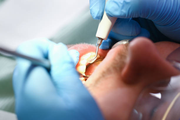 Best Chipped Tooth Repair Near Me  in Whitesboro, NJ